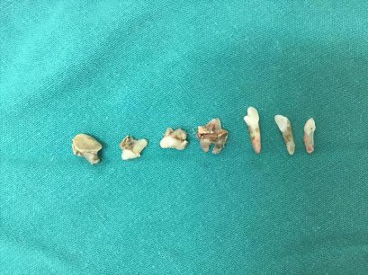 บี้เกิ้ลท้องโย้แต่คลอดไม่ออก คุณหมอช่วยด้วยข้อมูลสัตว์ป่วย “คิตตี้”เป็นแม่แมวร่างน้อย สายพันธุ์ British Shorthair เพศเมีย อายุ 1 ปี เข้ารับการรักษาที่โรงพยาบาลสัตว์ไอเว็ทด้วยอาการคลอดลำบาก โดยเจ้าของสังเกตพบว่าภายหลังจากน้องคิตตี้มีน้ำคร่ำไหลออกทางอวัยวะเ